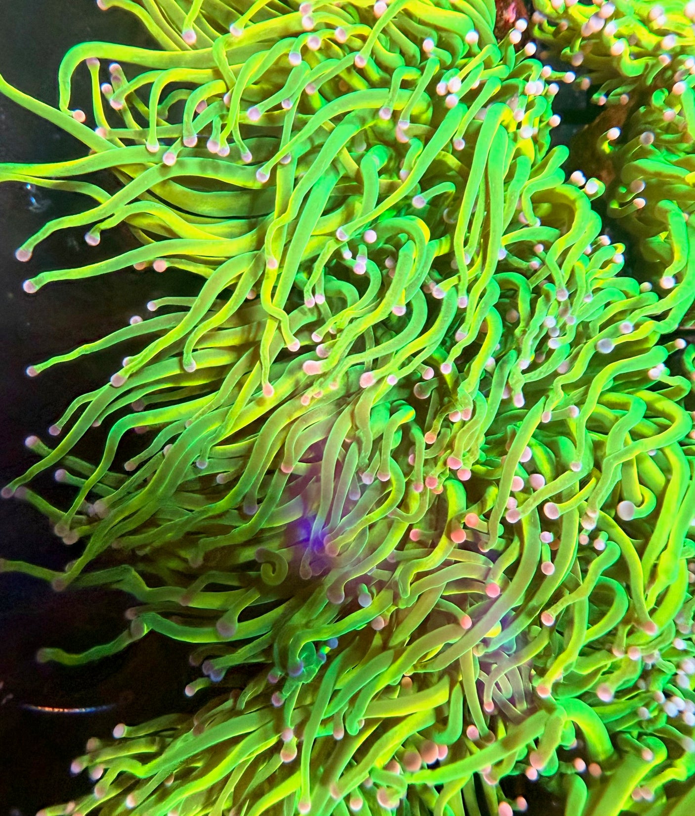 ASD Holy Grail (single head)